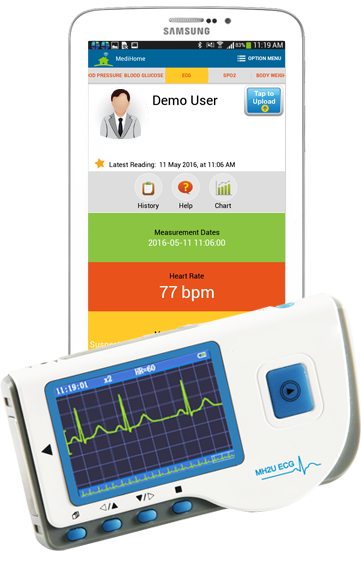 ECG Device